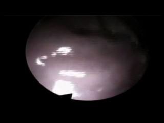 320px x 240px - Camera Inside The Vagina During Sex Hot Porn - Watch and Download Camera  Inside The Vagina During Sex mp4 video at 6kea.com